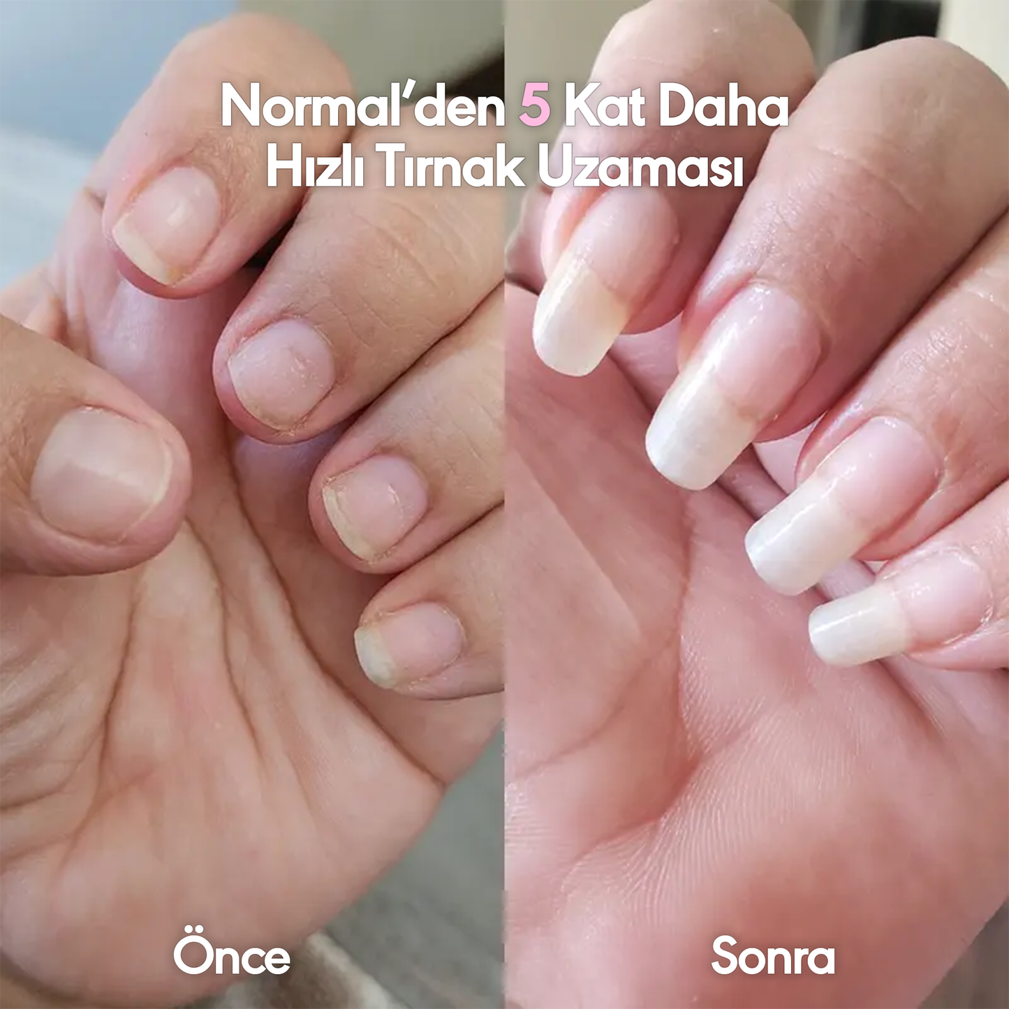 Yamis® Tırnak Bakım Kalemi