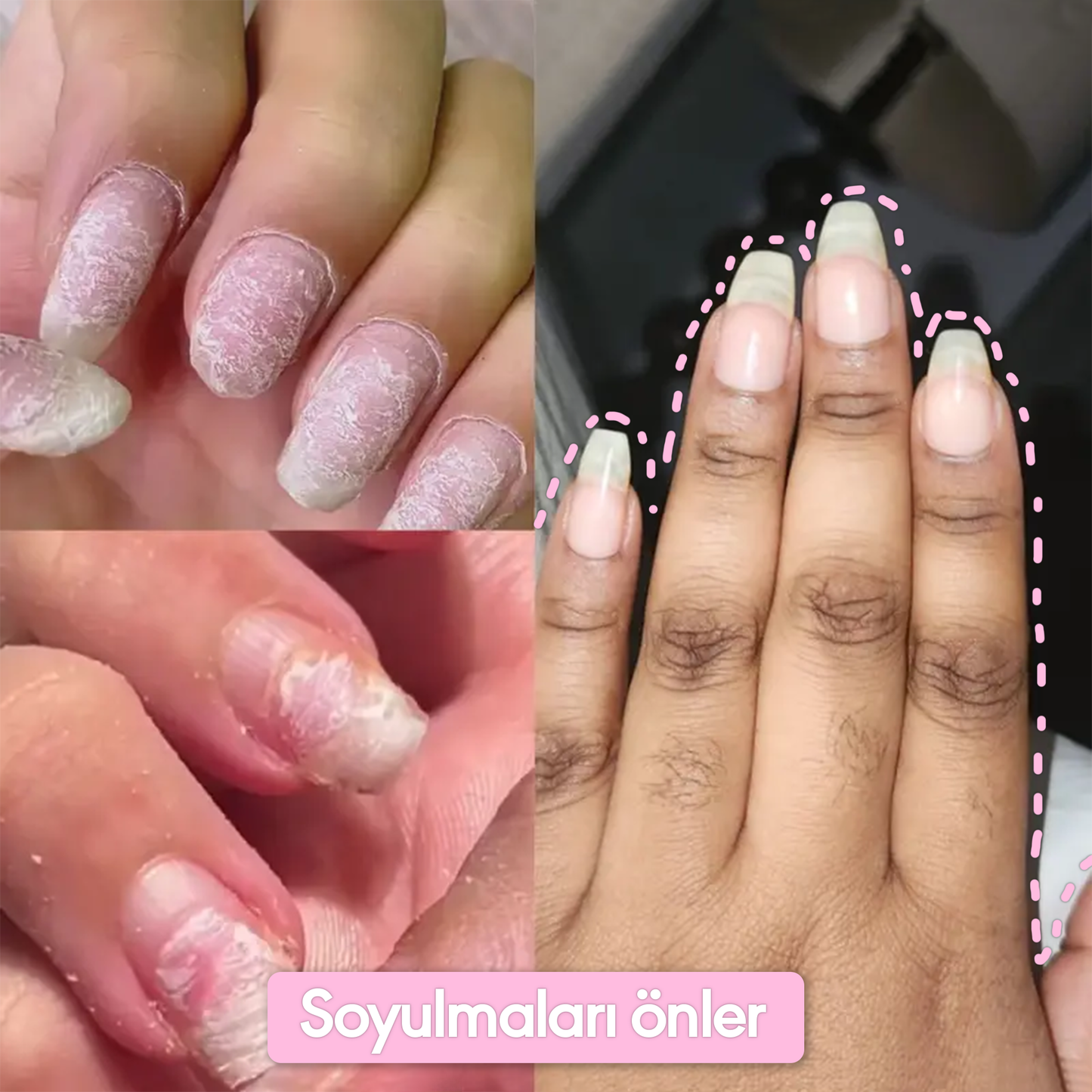 Yamis® Tırnak Bakım Kalemi