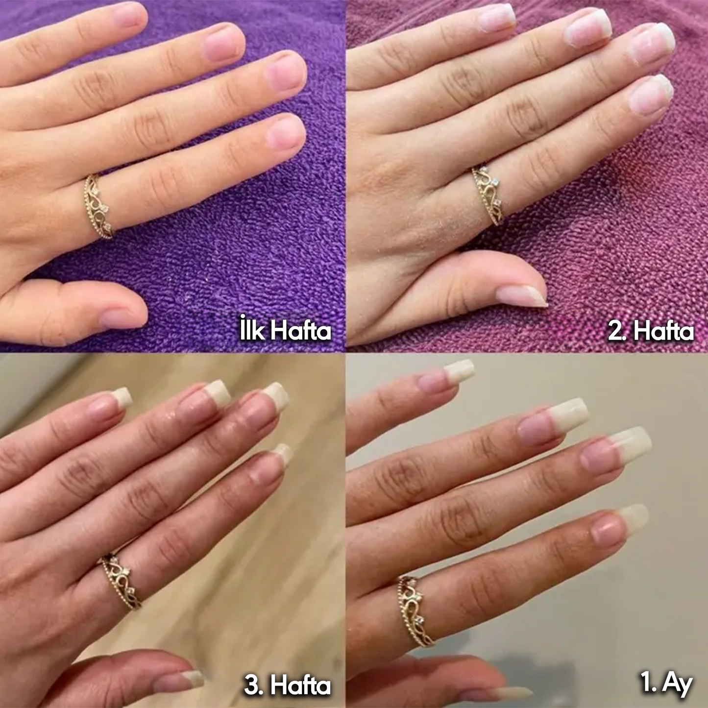 Yamis® Tırnak Bakım Kalemi